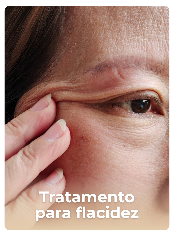 Procedimento de Skinbooster